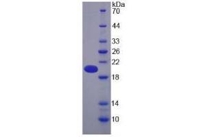 Image no. 1 for Pregnancy Zone Protein (PZP) (AA 1212-1391) protein (His tag) (ABIN1171180)
