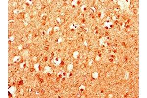Immunohistochemistry of paraffin-embedded human brain tissue using ABIN7158987 at dilution of 1:100
