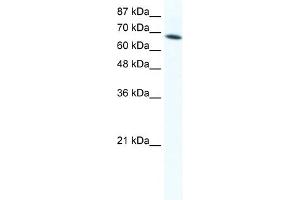 WB Suggested Anti-DDX1 Antibody Titration:  1. (DDX1 Antikörper  (C-Term))