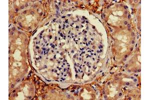 Immunohistochemistry of paraffin-embedded human kidney tissue using ABIN7174772 at dilution of 1:100