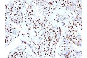 FFPE human testicular carcinoma tested with Histone antibody (AE-4)