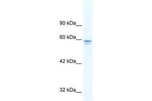 Western Blotting (WB) image for anti-Metal-Regulatory Transcription Factor 1 (MTF1) antibody (ABIN2460357)