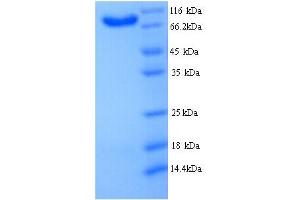 BANK1 Protein (AA 1-785, full length) (His tag)