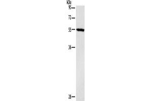 Gel: 10 % SDS-PAGE, Lysate: 40 μg, Lane: Mouse heart tissue, Primary antibody: ABIN7190465(DGAT1 Antibody) at dilution 1/1400, Secondary antibody: Goat anti rabbit IgG at 1/8000 dilution, Exposure time: 40 seconds (DGAT1 Antikörper)
