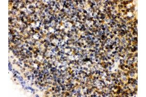 IHC testing of FFPE rat lymph node with PLK1 antibody.