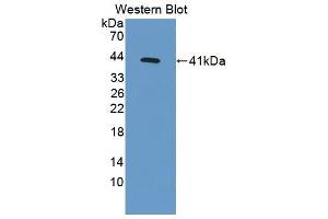 Western blot analysis of the recombinant protein. (MSMB Antikörper  (AA 21-113))