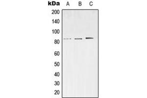 Western blot analysis of SV2C expression in SKNSH (A), Neuro2A (B), PC12 (C) whole cell lysates. (SV2C Antikörper  (Center))