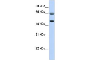 WB Suggested Anti-FAM113A Antibody Titration:  0. (FAM113A Antikörper  (C-Term))