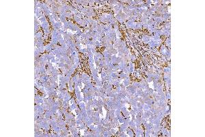 IHC analysis of SEMA4F using anti-SEMA4F antibody (ABIN7601432).