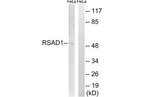 Western blot analysis of extracts from HeLa cells, using RSAD1 antibody. (RSAD1 Antikörper  (Internal Region))