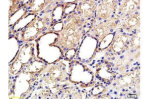 Formalin-fixed and paraffin embedded human kidney labeled with Anti ANGPTL3/ANG5 Polyclonal Antibody, Unconjugated (ABIN759806) at 1:200 followed by conjugation to the secondary antibody and DAB staining