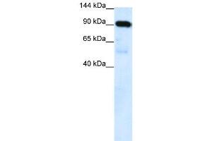 WB Suggested Anti-SUV420H1  Antibody Titration: 0. (SUV420H1 Antikörper  (Middle Region))