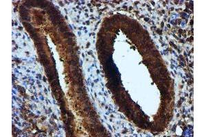 Immunohistochemical staining of paraffin-embedded Human endometrium tissue using anti-KEAP1 mouse monoclonal antibody. (KEAP1 Antikörper)