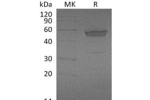 Western Blotting (WB) image for Ectodysplasin A2 Receptor (EDA2R) protein (Fc Tag) (ABIN7320838)