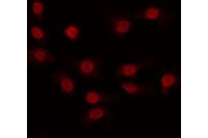 ABIN6266900 staining COLO by IF/ICC. (CDK11 Antikörper  (Internal Region))