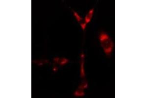 ABIN6276665 staining  Hela cells by IF/ICC. (CYP1B1 Antikörper  (Internal Region))