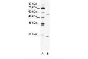 Image no. 1 for anti-Zinc Finger Protein 18 (ZNF18) (N-Term) antibody (ABIN202745) (ZNF18 Antikörper  (N-Term))
