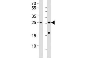 Western blot testing of RHOXF1 antibody at 1:1000; Lane 1: HL-60 whole lysate; Lane 2: human testis lysate.