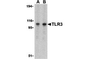 Western Blotting (WB) image for anti-Toll-Like Receptor 3 (TLR3) (C-Term) antibody (ABIN1030743) (TLR3 Antikörper  (C-Term))