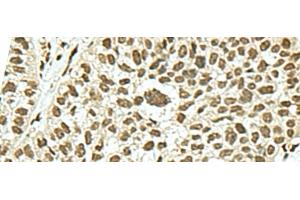 Immunohistochemistry (Paraffin-embedded Sections) (IHC (p)) image for anti-KH-Type Splicing Regulatory Protein (KHSRP) antibody (ABIN7245482)