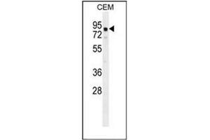 Western blot analysis of GLB1L2 Antibody (C-term) in CEM cell line lysates (35ug/lane). (GLB1L2 Antikörper  (C-Term))