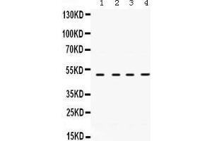 Western Blotting (WB) image for anti-Ribonucleotide Reductase M2 (RRM2) (AA 1-33), (N-Term) antibody (ABIN3043425) (RRM2 Antikörper  (N-Term))