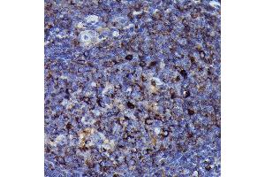 Immunohistochemistry of paraffin-embedded human tonsil using Human IgM Rabbit mAb (ABIN7267845) at dilution of 1:100 (40x lens). (IGHM Antikörper)
