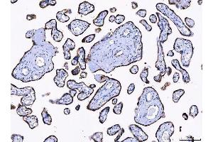 IHC analysis of LNPEP using anti-LNPEP antibody (ABIN7600279). (LNPEP Antikörper  (AA 17-994))