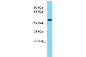 Host: Rabbit Target Name: KIAA1257 Sample Type: Fetal Brain lysates Antibody Dilution: 1. (CFAP92/KIAA1257 Antikörper  (C-Term))