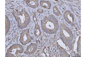 IHC analysis of ARL1 using anti-ARL1 antibody (ABIN7602848). (ARL1 Antikörper  (C-Term))