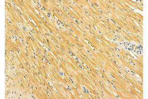 ABIN6265094 and ABIN6278291 at 1/100 staining Rat heart tissue by IHC-P.