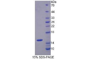 Image no. 1 for Solute Carrier Family 22 Member 4 (SLC22A4) (AA 42-141) protein (His tag) (ABIN6237904) (SLC22A4 Protein (AA 42-141) (His tag))