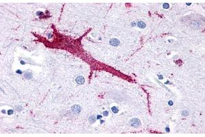 Anti-GPR116 antibody  ABIN1048694 IHC staining of human brain, neuron. (G Protein-Coupled Receptor 116 Antikörper  (N-Term))