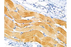 ABIN6258888 and ABIN6274835 at 1/100 staining Rat skin tissue by IHC-P. (SGCA Antikörper  (Internal Region))