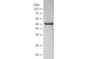 Western Blotting (WB) image for 3-Oxoacyl-ACP Synthase, Mitochondrial (OXSM) (AA 28-459) protein (His tag) (ABIN7121614) (OXSM Protein (AA 28-459) (His tag))