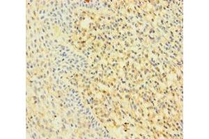 Immunohistochemistry of paraffin-embedded human tonsil tissue using ABIN7167200 at dilution of 1:100 (RAC2 Antikörper  (AA 1-189))