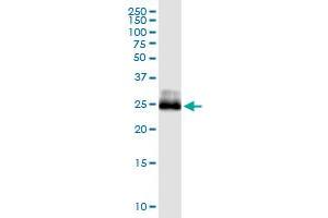 Immunoprecipitation of CITED1 transfected lysate using anti-CITED1 MaxPab rabbit polyclonal antibody and Protein A Magnetic Bead , and immunoblotted with CITED1 monoclonal antibody (M01), clone 6G8 . (CITED1 Antikörper  (AA 1-193))