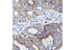 Immunohistochemistry (IHC) image for anti-Thrombospondin 1 (THBS1) (AA 80-360) antibody (ABIN3022979)