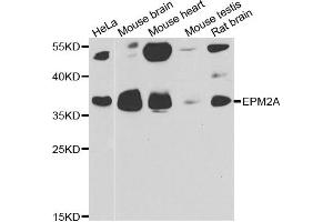 Western blot analysis of extracts of various cell lines, using EPM2A antibody.