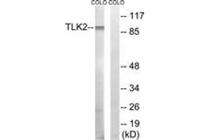 Western Blotting (WB) image for anti-Tousled-Like Kinase 2 (TLK2) (AA 191-240) antibody (ABIN2890622) (TLK2 Antikörper  (AA 191-240))