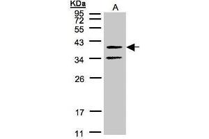 WB Image Sample(30 μg of whole cell lysate) A:A431, 12% SDS PAGE antibody diluted at 1:500 (GALR2 Antikörper  (C-Term))