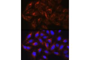 Immunofluorescence analysis of U-2 OS cells using HGS Rabbit pAb (ABIN6131749, ABIN6141748, ABIN6141749 and ABIN6218898) at dilution of 100 (40x lens). (HGS Antikörper  (AA 548-777))