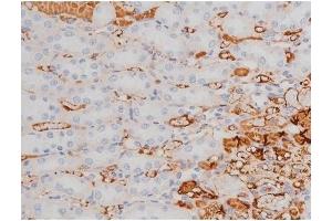 ABIN6255614 and ABIN6267361 at 1/200 staining Rat kidney tissue sections by IHC-P. (MAPT Antikörper  (pThr181))