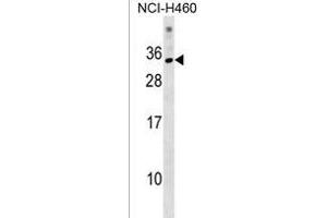 KRBOX1 Antibody (C-term) (ABIN1537656 and ABIN2838166) western blot analysis in NCI- cell line lysates (35 μg/lane). (KRBOX1 Antikörper  (C-Term))
