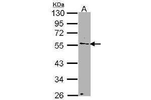 WB Image Sample (30 ug of whole cell lysate) A: H1299 10% SDS PAGE antibody diluted at 1:1000 (NUP50 Antikörper  (C-Term))