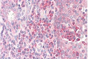 Immunohistochemistry (IHC) image for anti-Ribosomal Protein S19 (RPS19) (Internal Region) antibody (ABIN185519)
