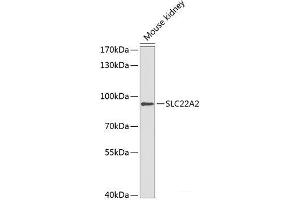Western blot analysis of extracts of Mouse kidney using SLC22A2 Polyclonal Antibody at dilution of 1:1000. (SLC22A2 Antikörper)