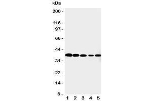 Western blot testing of Cdk7 antibody and Lane 1:  HeLa;  2: MCF-7;  3: A549;  4: COLO320;  5: Jurkat cell lysate. (CDK7 Antikörper  (C-Term))