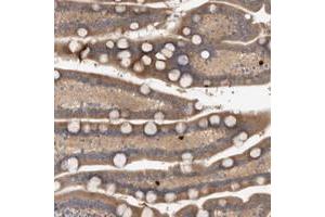 Immunohistochemical staining of human duodenum with TARBP1 polyclonal antibody  shows cytoplasmic positivity in glandular cells. (TARBP1 Antikörper)