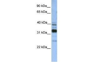 WB Suggested Anti-TXNDC13 Antibody Titration:  0. (TMX4 Antikörper  (C-Term))